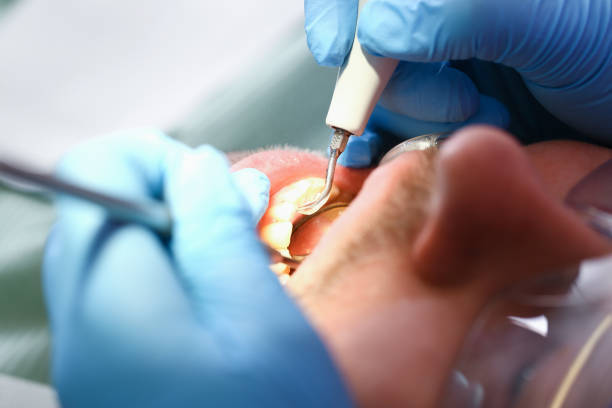 Best Emergency Dental Care for Trauma or Injury in Prosperity, SC