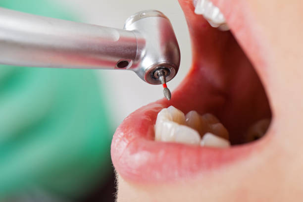 Best Pediatric Emergency Dentist in Prosperity, SC